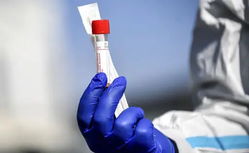 Test Coronavirus