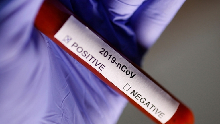 Test Coronavirus