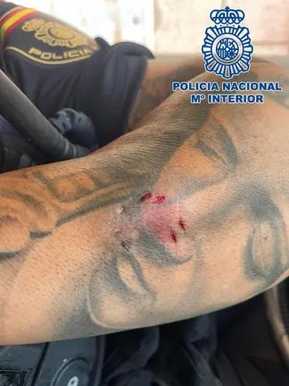 Huella del mordisco en el brazo de uno de los agentes
