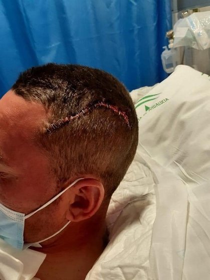 El ex jugador ha tenido que recibir más de veinte puntos de sutura en la cabeza
